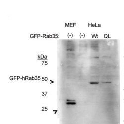 RAB35 Antibody, Novus Biologicals 100&mu;L; Unlabeled:Antibodies, Polyclonal
