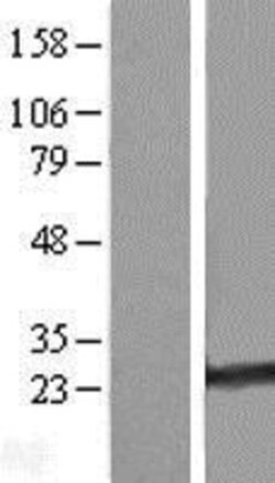 Novus Biologicals&trade;&nbsp;RAB35 Overexpression Lysate