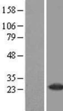 Novus Biologicals&trade;&nbsp;RAB37 Overexpression Lysate