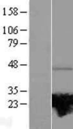 Novus Biologicals&trade;&nbsp;RAB37 Overexpression Lysate