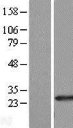 Novus Biologicals&trade;&nbsp;RAB39B Overexpression Lysate