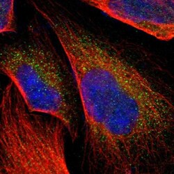 RAB39B Antibody, Novus Biologicals 0.1mL; Unlabeled:Antibodies, Polyclonal