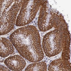 RAB39B Antibody, Novus Biologicals 0.1mL; Unlabeled:Antibodies, Polyclonal