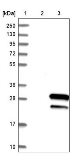RAB39B Antibody, Novus Biologicals 0.1mL; Unlabeled:Antibodies, Polyclonal