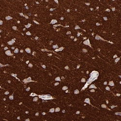 Rab3A Antibody, Novus Biologicals:Antibodies:Primary Antibodies