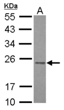 RAB3B Antibody, Novus Biologicals 0.1mL; Unlabeled:Antibodies, Polyclonal