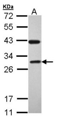Rab3C Antibody, Novus Biologicals 0.1mL; Unlabeled:Antibodies, Polyclonal