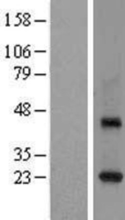 Novus Biologicals&trade;&nbsp;Rab3C Overexpression Lysate