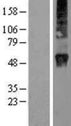 Novus Biologicals&trade;&nbsp;Rab3D Overexpression Lysate