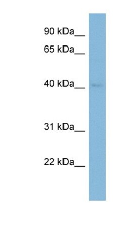 RAB3IL1 Antibody, Novus Biologicals 100&mu;L; Unlabeled:Antibodies, Polyclonal