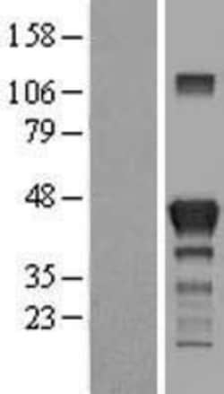 Novus Biologicals&trade;&nbsp;RAB3IL1 Overexpression Lysate