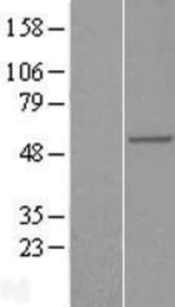 Novus Biologicals&trade;&nbsp;RAB3IP Overexpression Lysate