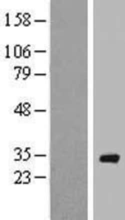 Novus Biologicals&trade;&nbsp;RAB40A Overexpression Lysate