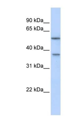 RAB40B Antibody, Novus Biologicals:Antibodies:Primary Antibodies