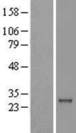 Novus Biologicals&trade;&nbsp;RAB41 Overexpression Lysate
