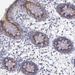 RAB41 Antibody, Novus Biologicals:Antibodies:Primary Antibodies