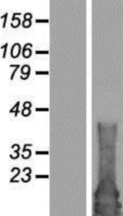 Novus Biologicals&trade;&nbsp;RAB4B Overexpression Lysate