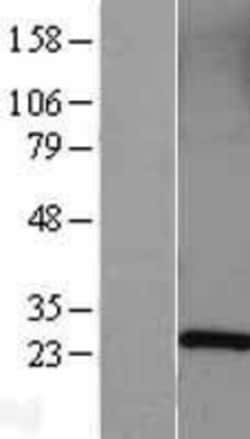 Novus Biologicals&trade;&nbsp;Rab5a Overexpression Lysate