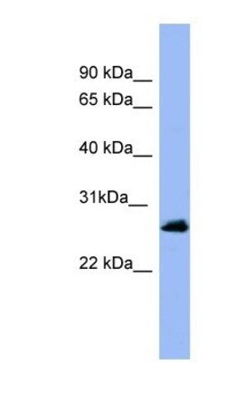 Rab5a Antibody, Novus Biologicals 0.05mg; Unlabeled:Antibodies, Polyclonal