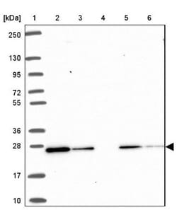 RAB6A Antibody, Novus Biologicals 0.1mL; Unlabeled:Antibodies, Polyclonal