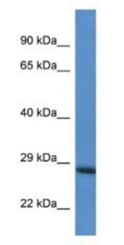 RAB6C Antibody, Novus Biologicals 100&mu;L; Unlabeled:Antibodies, Polyclonal