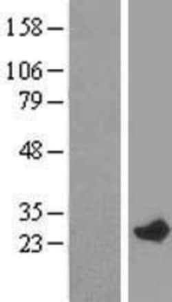 Novus Biologicals&trade;&nbsp;RAB7L1 Overexpression Lysate