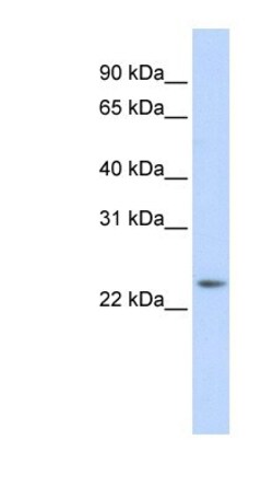 RAB8A Antibody, Novus Biologicals 0.05mg; Unlabeled:Antibodies, Polyclonal