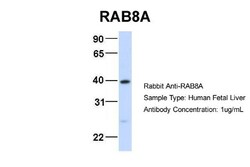 RAB8A Antibody, Novus Biologicals 0.05mg; Unlabeled:Antibodies, Polyclonal