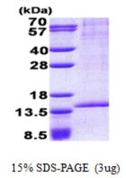 Novus Biologicals&trade;&nbsp;Recombinant Human RAB8B His Protein