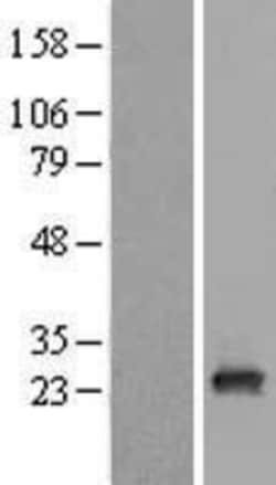 Novus Biologicals&trade;&nbsp;RAB9B Overexpression Lysate