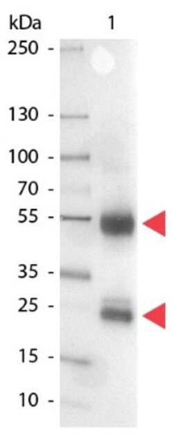Rabbit anti-Porcine IgG (H+L) Secondary Antibody, Alkaline Phosphatase, Novus Biologicals 1 mg | Buy Online | Novus Biologicals | Fisher Scientific