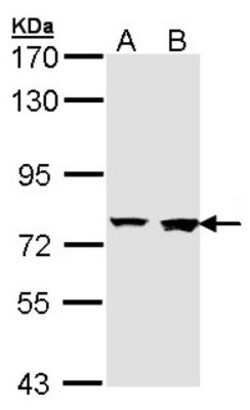 Rabenosyn 5 Antibody, Novus Biologicals 0.1mL; Unlabeled:Antibodies, Polyclonal