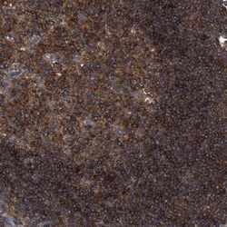 RABEP1 Antibody, Novus Biologicals 25 &mu;L; Unlabeled:Antibodies, Polyclonal
