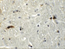 Rabex5 Antibody - BSA Free, Novus Biologicals 0.1mg; Unlabeled:Antibodies,