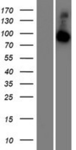 Novus Biologicals™ RABGAP1L Overexpression Lysate