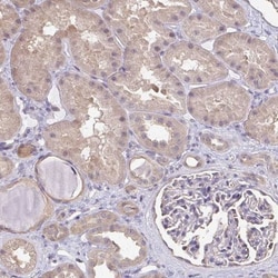 RABGAP1L Antibody, Novus Biologicals 25 &mu;L, Unlabeled:Antibodies, Polyclonal