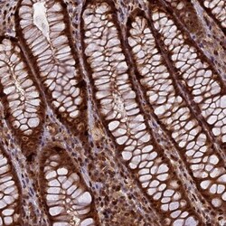RABGGTA Antibody, Novus Biologicals 25 &mu;L; Unlabeled:Antibodies, Polyclonal