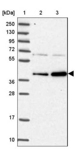 RABGGTA Antibody, Novus Biologicals 25 &mu;L; Unlabeled:Antibodies, Polyclonal