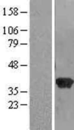 Novus Biologicals&trade;&nbsp;RABGGTB Overexpression Lysate