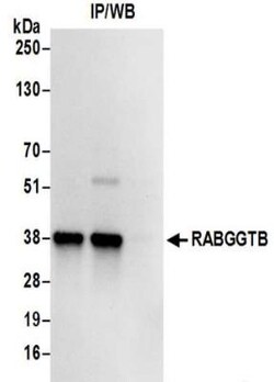 RABGGTB Antibody, Novus Biologicals 100 &mu;L | Buy Online | Novus Biologicals | Fisher Scientific