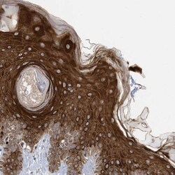 RABL3 Antibody, Novus Biologicals 0.1 mL | Buy Online | Novus Biologicals | Fisher Scientific