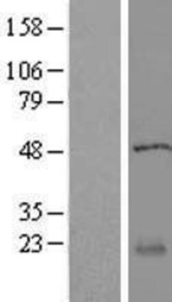 Novus Biologicals&trade;&nbsp;RABL5 Overexpression Lysate
