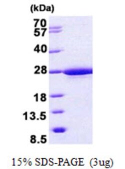 Novus Biologicals&trade;&nbsp;Recombinant Human RABL5 His Protein