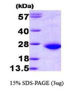 Novus Biologicals&trade;&nbsp;Recombinant Human Rac1 His Protein
