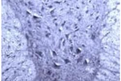 Rac1 Antibody, Novus Biologicals 0.1 mL; Unconjugated:Antibodies, Polyclonal