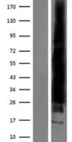 Novus Biologicals™ RAC2 Overexpression Lysate