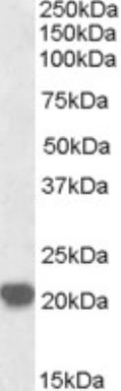 RAC2 Antibody, Novus Biologicals 0.1mg; Unlabeled:Anticuerpos