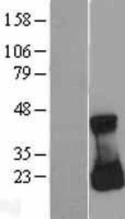 Novus Biologicals&trade;&nbsp;RAC3 Overexpression Lysate