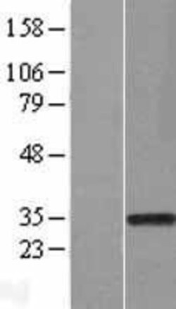 Novus Biologicals&trade;&nbsp;Rad1 Overexpression Lysate