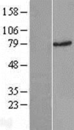 Novus Biologicals&trade;&nbsp;Rad17 Overexpression Lysate